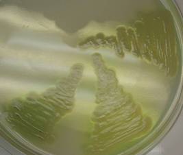 pseudomonas aeruginosa on macconkey agar